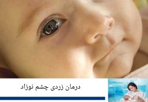 درمان زردی چشم نوزاد