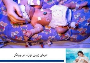 درمان زردی نوزاد در چیتگر